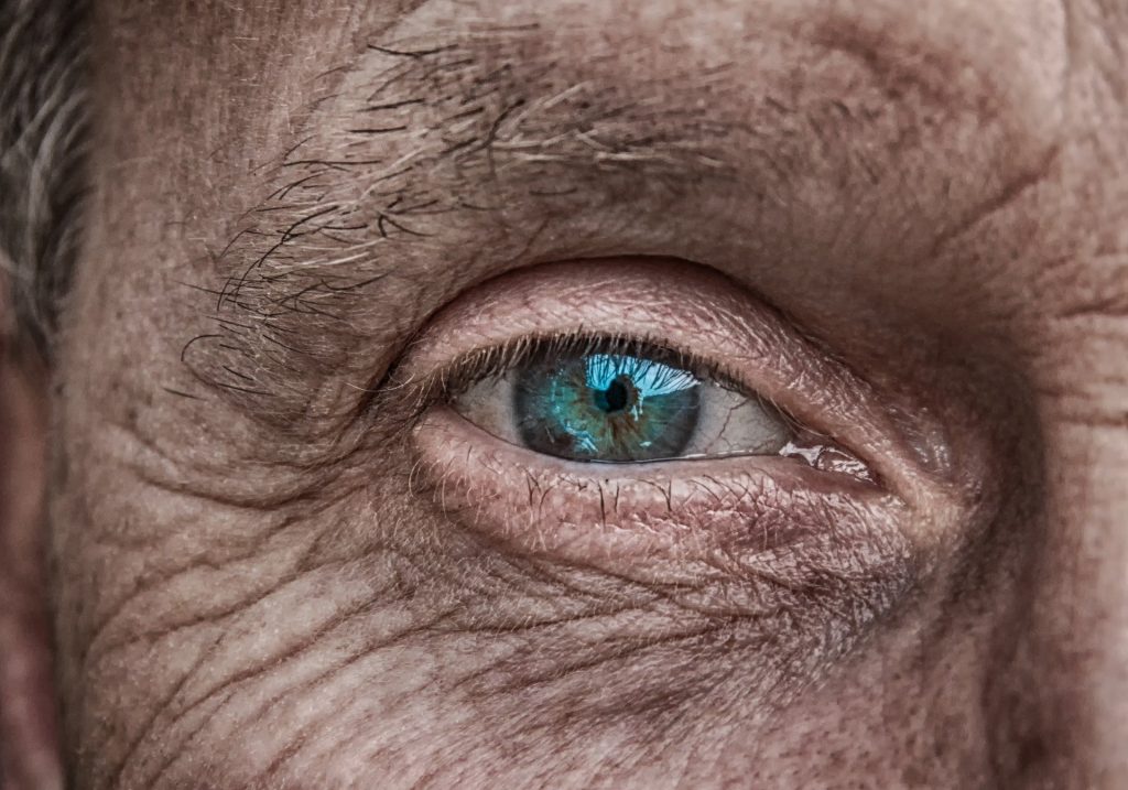 An old person's eye